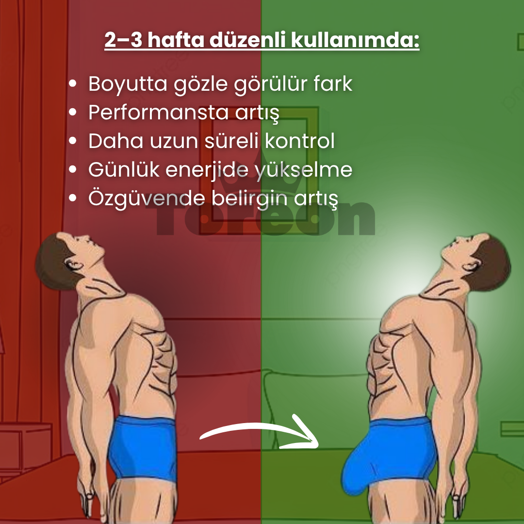 Toreon™ Erkek Performans ve Boyut Destek Cihazı